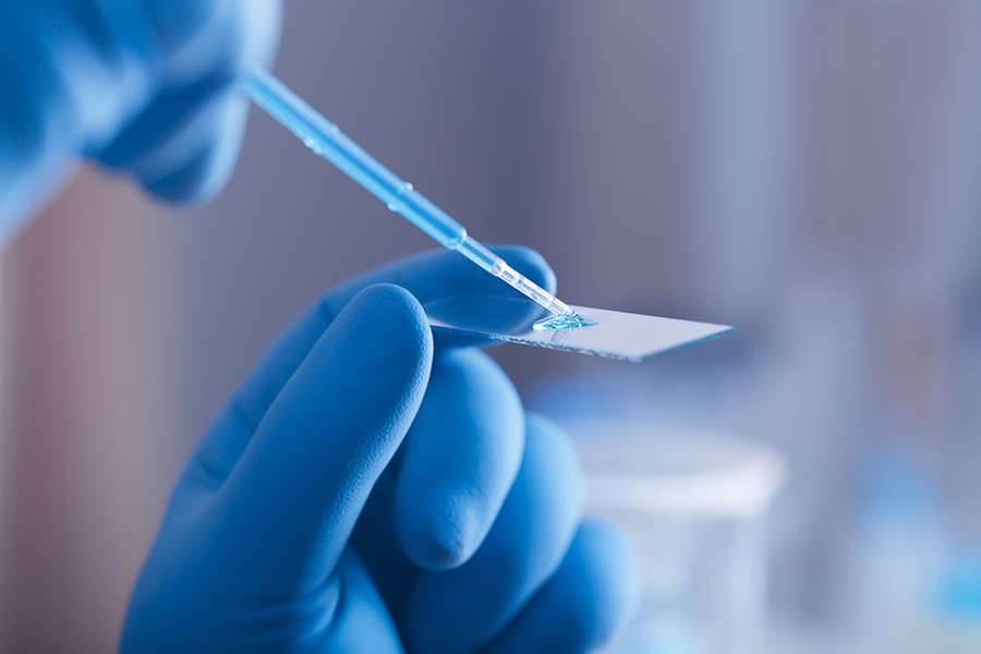 A gloved hand holds a glass slide while a pipette deposits liquid onto it, in a laboratory setting.